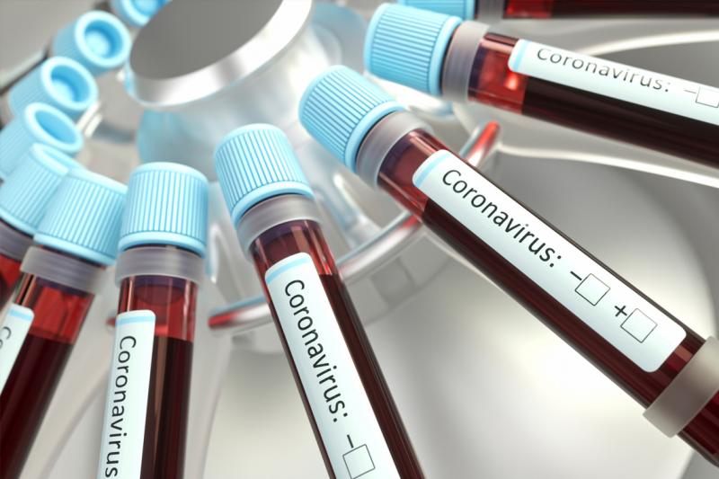 An array of narrow plastic vials of blood labelled: coronavirus.