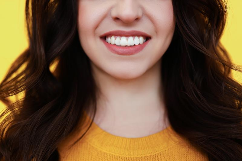 A woman smiles. Her teeth are very white.