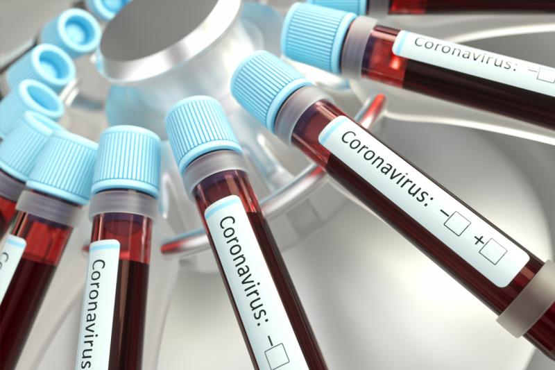 An array of narrow plastic vials of blood labelled: coronavirus.