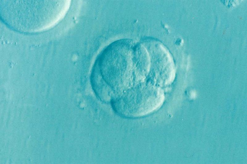 Magnified thousands of times, as a stem cell multiples, it looks like four oval blobs stuck together.