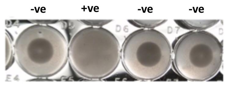 Three petri dishes show a dot, meaning a negative test, while one is uniformly gray, meaning a positive test.