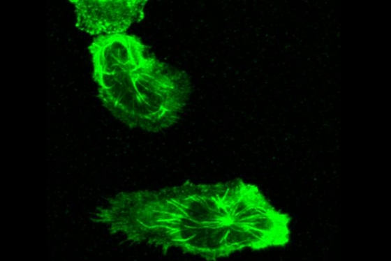This image of the cell structures called neutrophils shows elongated blobby shapes with stringy filaments inside.