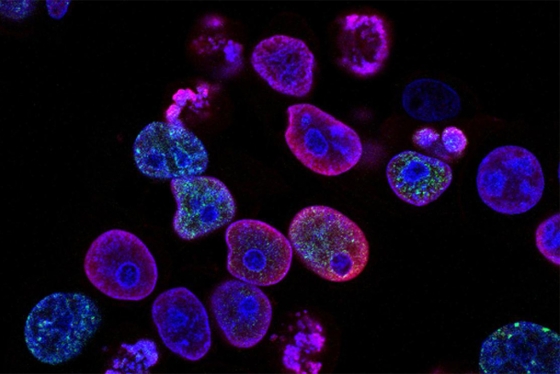 An image of human colorectal cancer cells: small blobs glowing against a dark background.