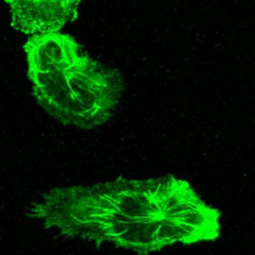 This image of the cell structures called neutrophils shows elongated blobby shapes with stringy filaments inside.