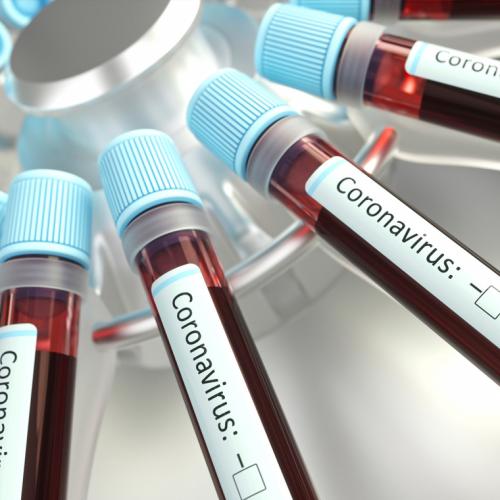 An array of narrow plastic vials of blood labelled: coronavirus.