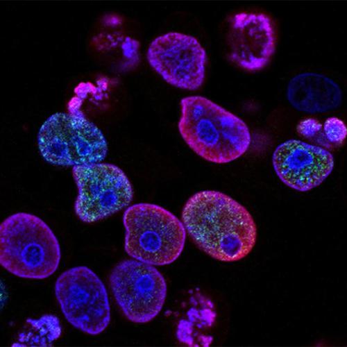 An image of human colorectal cancer cells: small blobs glowing against a dark background.