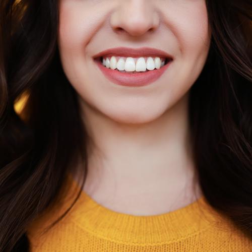 A woman smiles. Her teeth are very white.