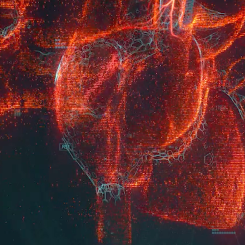 Anatomical heart image with a digital outline